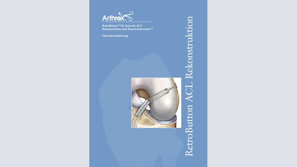 RetroButton® für femorale ACL Rekonstruktion und RetroConstruction™
