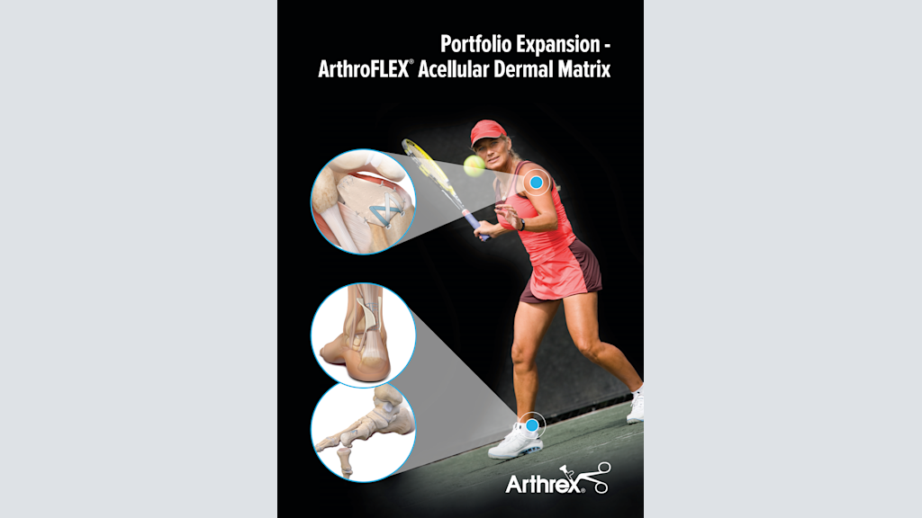 Portfolio Expansion - ArthroFLEX® Acellular Dermal Matrix
