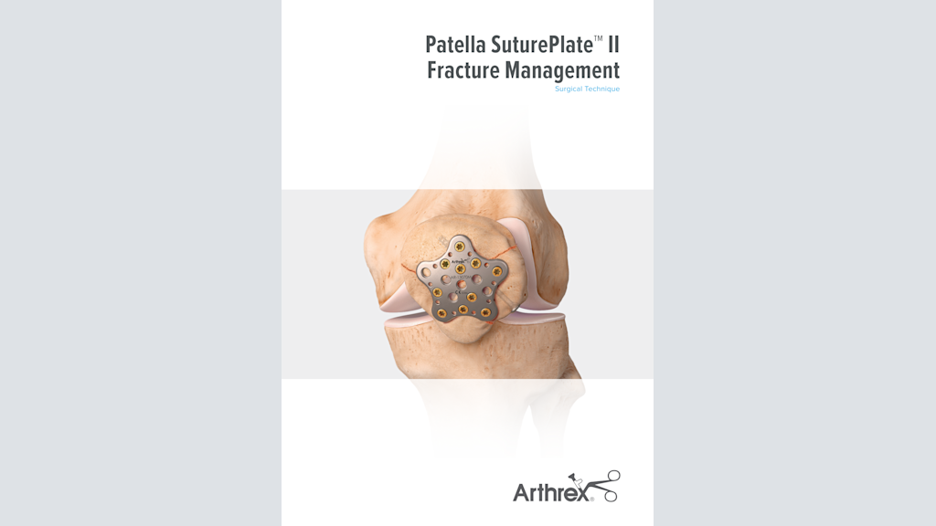 Patella SuturePlate™ II Fracture Management