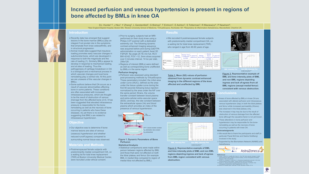Increased perfusion and venous hypertension is present in regions of bone affected by BMLs in knee OA