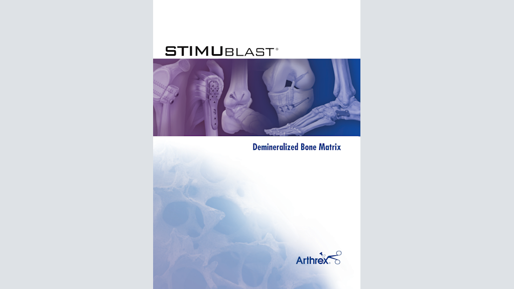 StimuBlast® Demineralized Bone Matrix