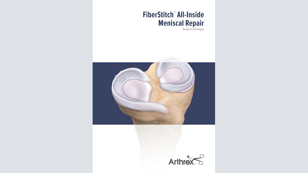 FiberStitch™ All-Inside Meniscal Repair