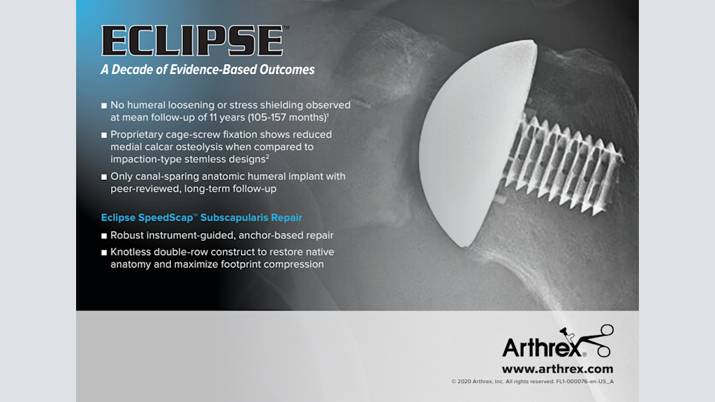 Arthrex Eclipse™ Total Shoulder System