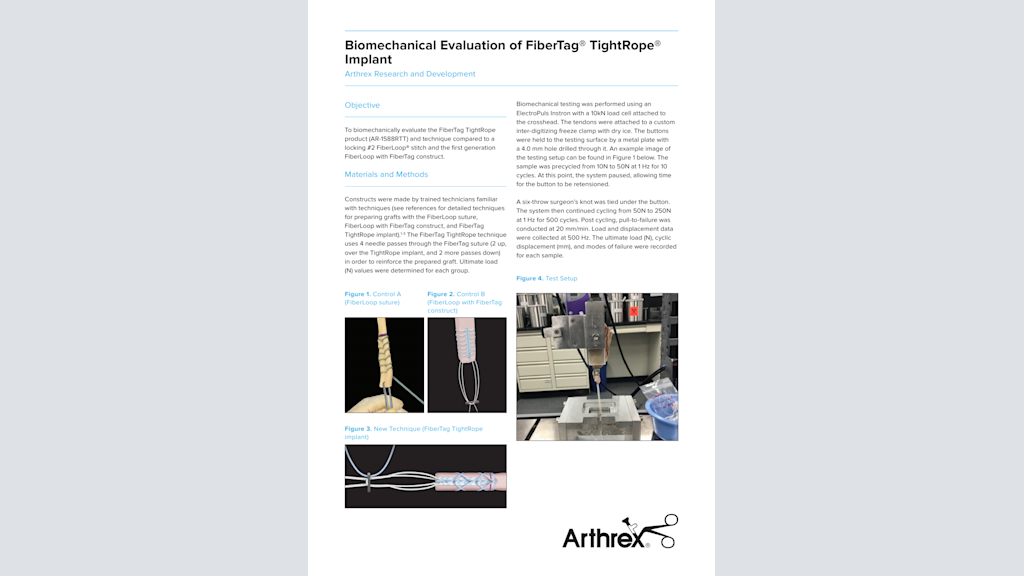Biomechanical Evaluation of FiberTag® TightRope® Implant