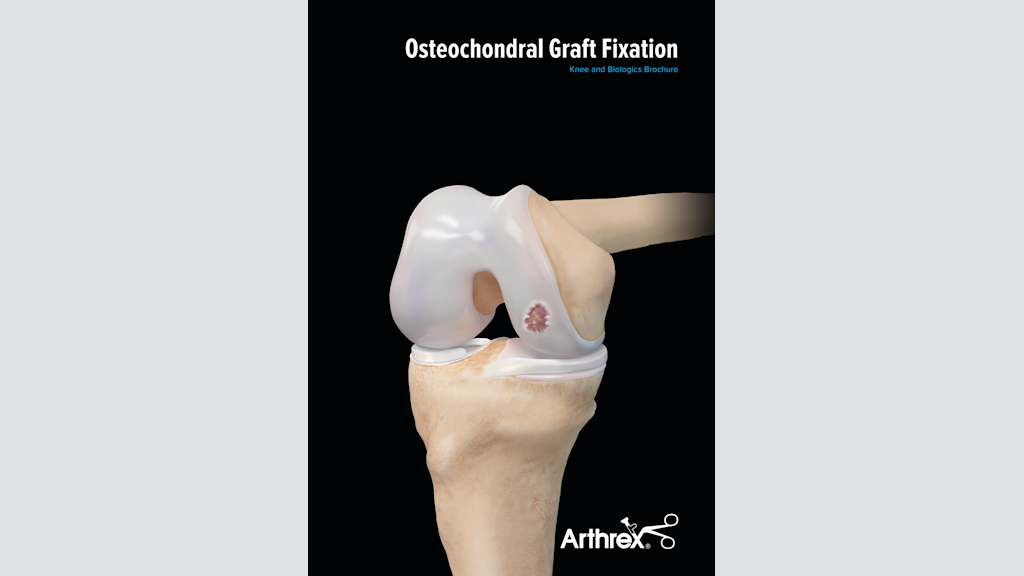 Osteochondral Graft Fixation