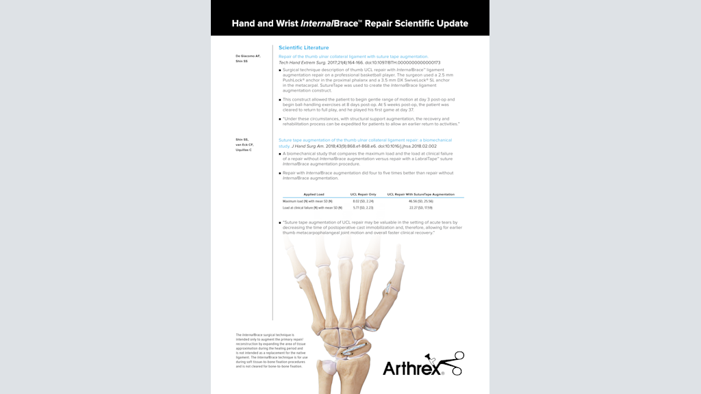 Hand and Wrist InternalBrace™ Repair Scientific Update