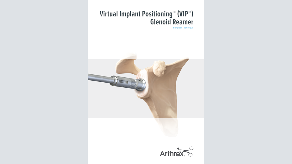 Virtual Implant Positioning™ (VIP™) Glenoid Reamer