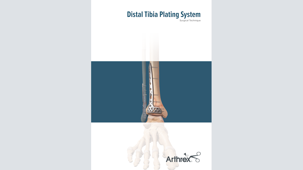 Distal Tibia Plating System
