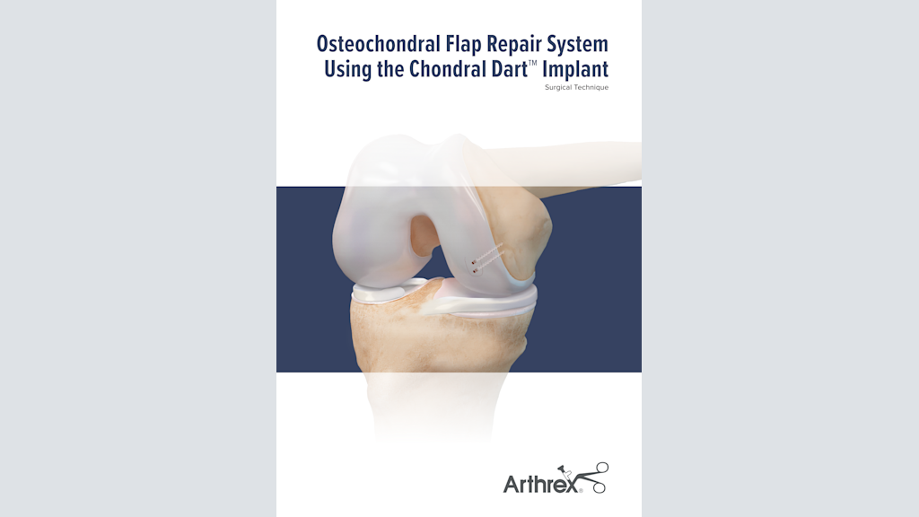 Osteochondral Flap Repair System Using the Chondral Dart™ Implant