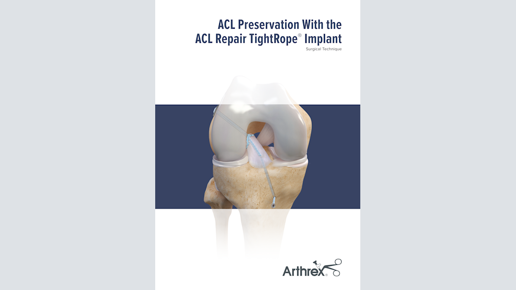 ACL Preservation With the ACL Repair TightRope® Implant