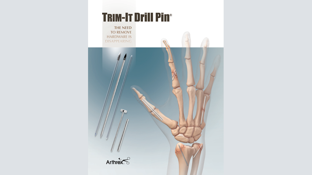 Trim-It Drill Pin® - The Need to Remove Hardware is Disappearing
