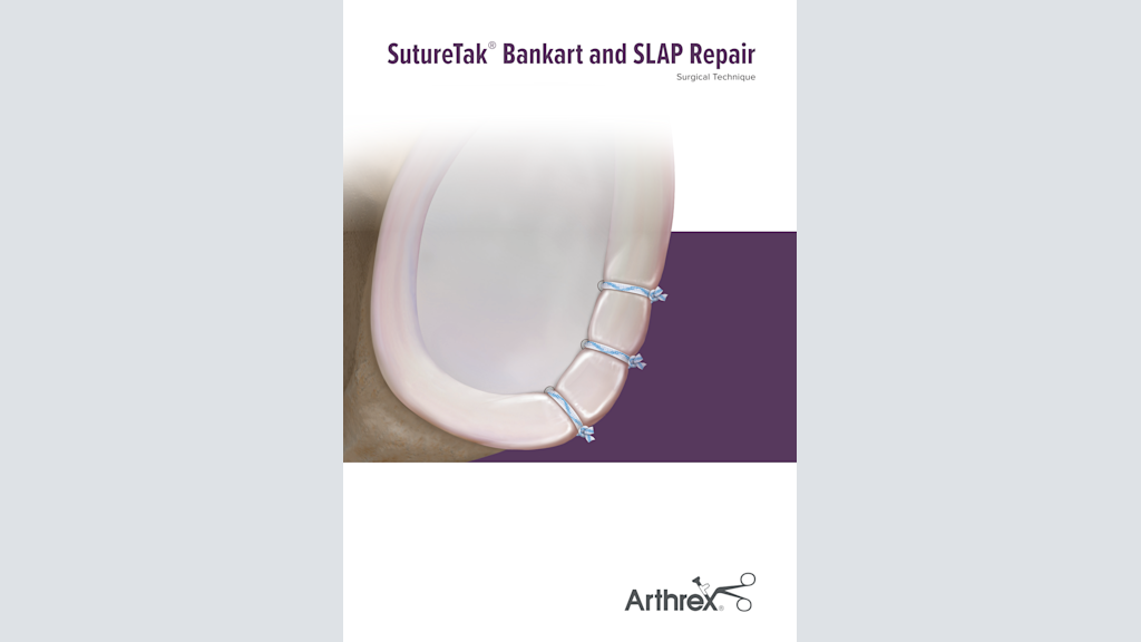 SutureTak® Bankart & SLAP Repair