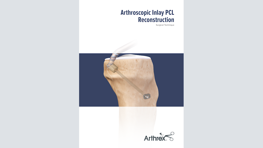 Arthroscopic Inlay PCL Reconstruction