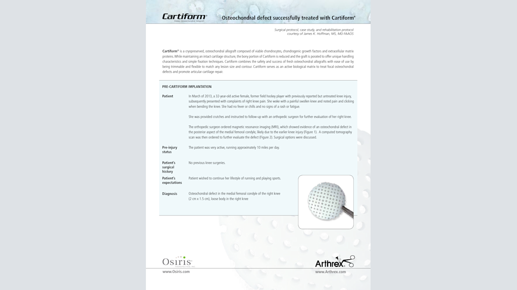Osteochondral Defect Successfully Treated with Cartiform®