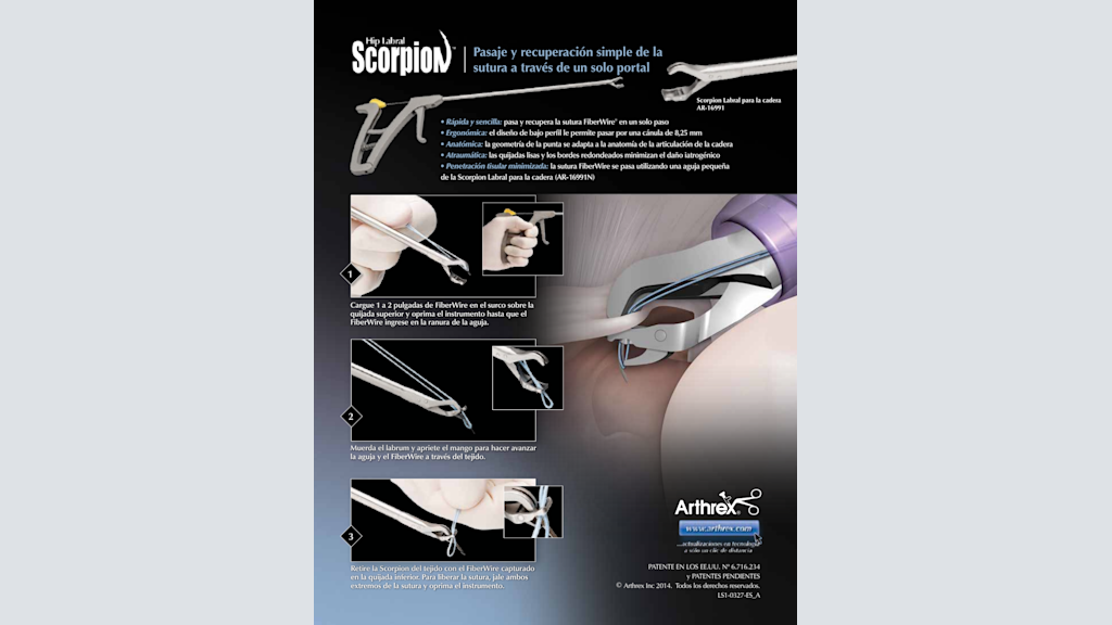 Scorpion™ Labral para cadera - Pasaje y recuperación simple de la sutura por un solo portal