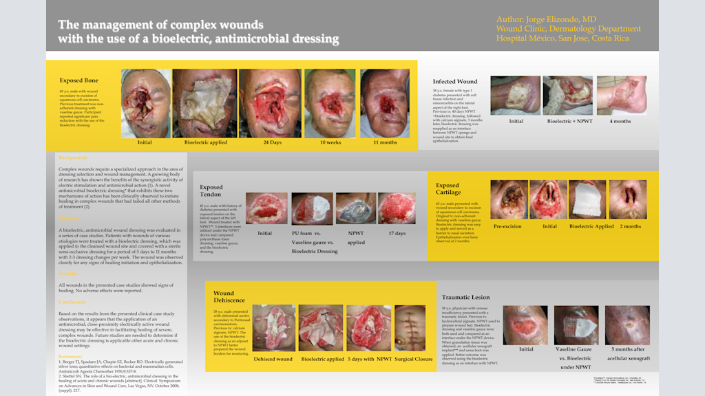 The management of complex wounds with the use of a bioelectric, antimicrobial dressing