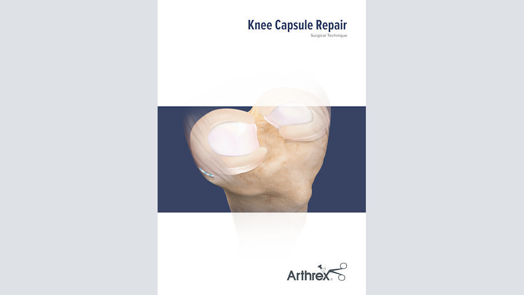 Knee Capsule Repair