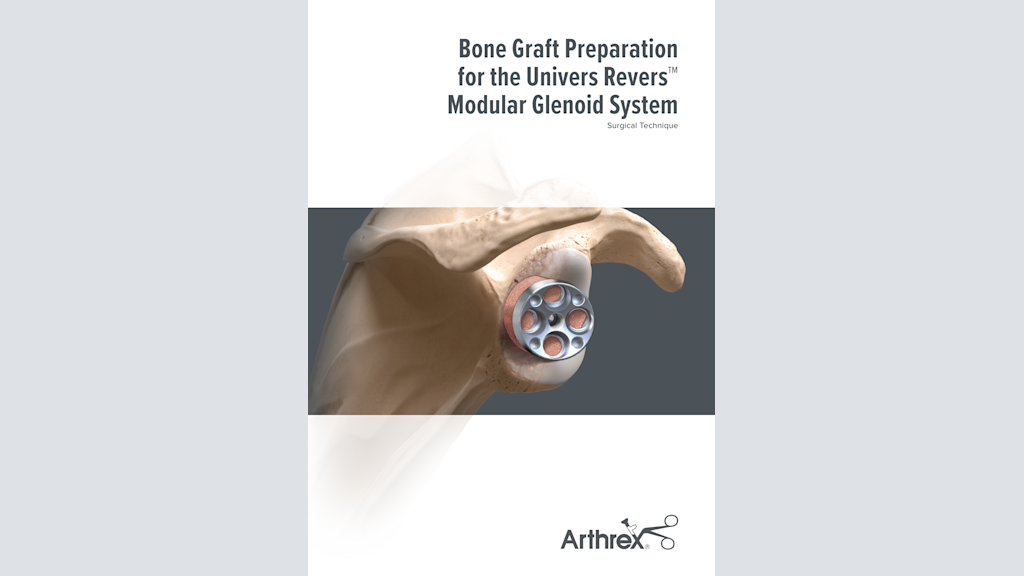 Bone Graft Preparation for the Univers Revers™ Modular Glenoid System