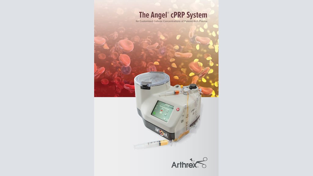 The Angel® cPRP System for Customized Cellular Concentrations of Platelet-Rich Plasma