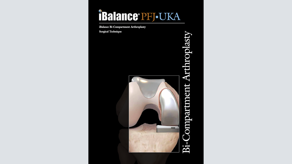 iBalance® Bi-Compartment Arthroplasty