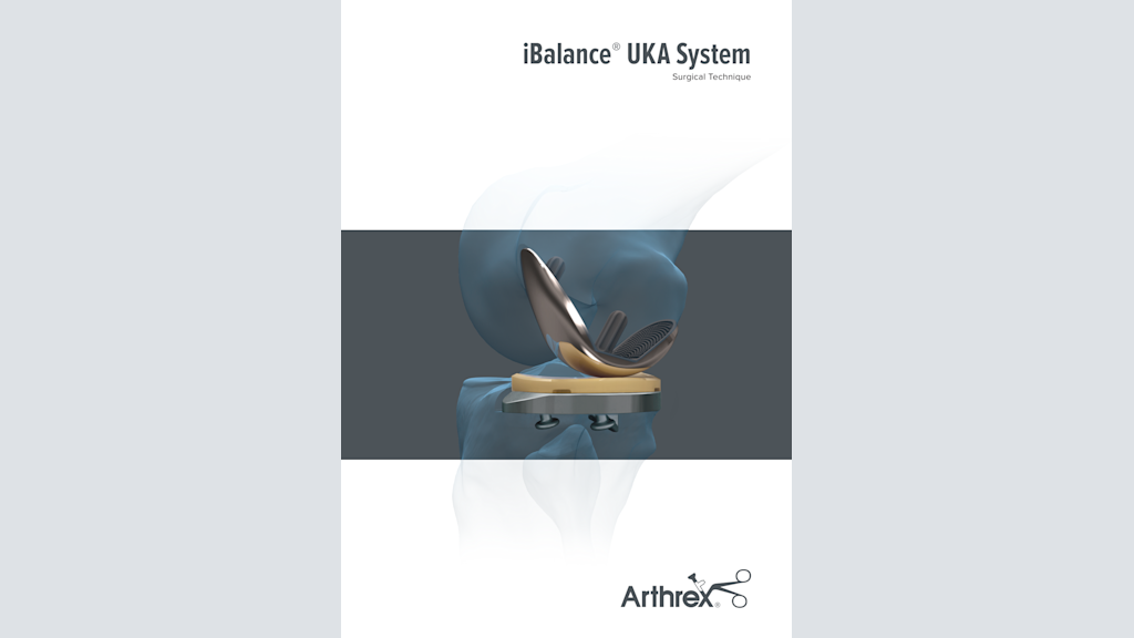 iBalance® UKA System Surgical Technique