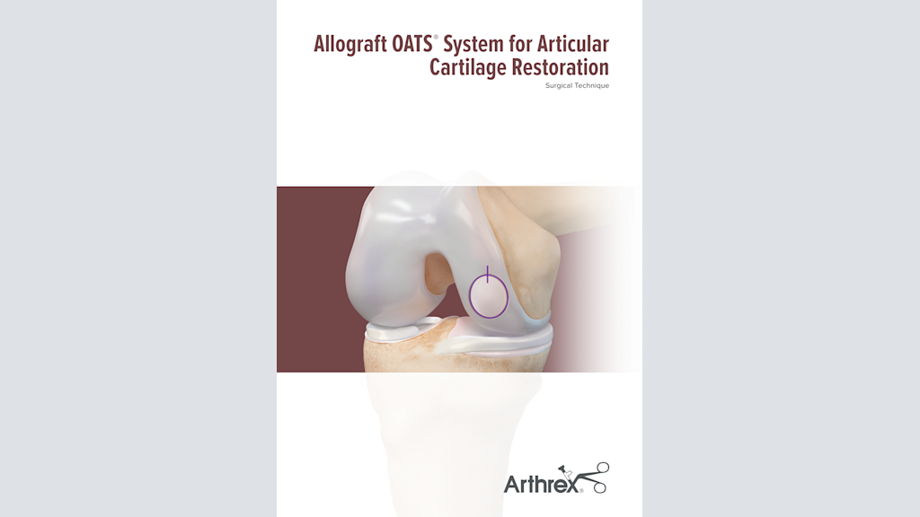 Allograft OATS® System for Articular Cartilage Restoration