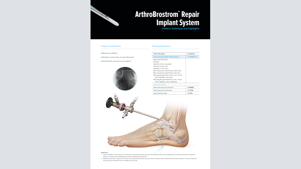 ArthroBrostrom™ Repair Implant System