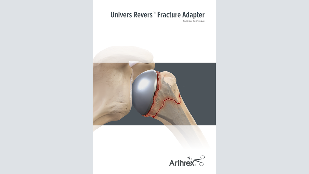 Univers Revers™ Fracture Adapter