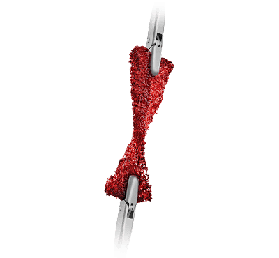 AlloSync™ Strips, Chips, Fibers, and Cubes