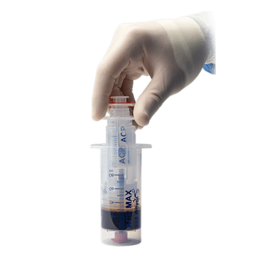 ACP Max™-PRP-System