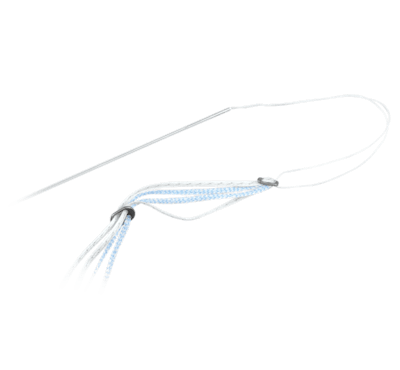 Sistema de fijación TightRope<sup>®</sup> 