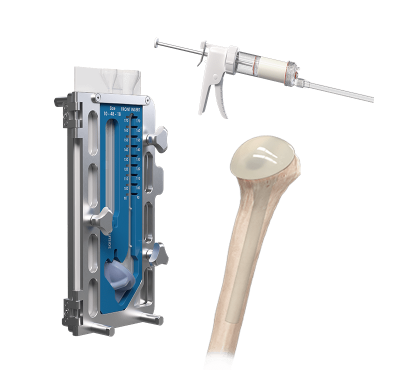 CeMend™ Shoulder Spacer Molds