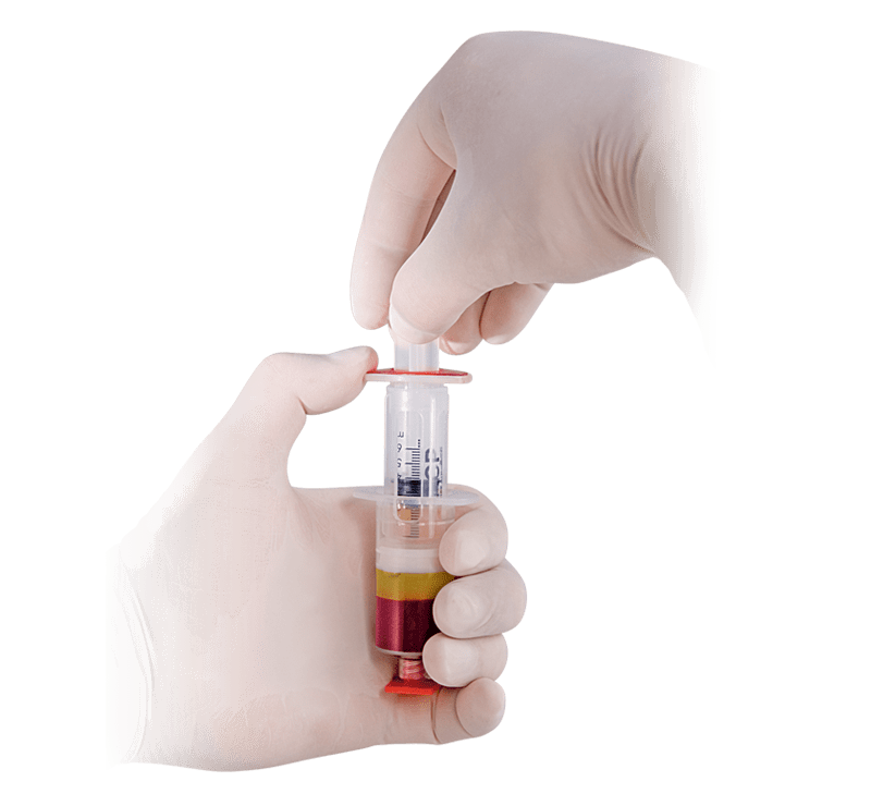 Arthrex ACP<sup>®</sup> Double-Syringe System