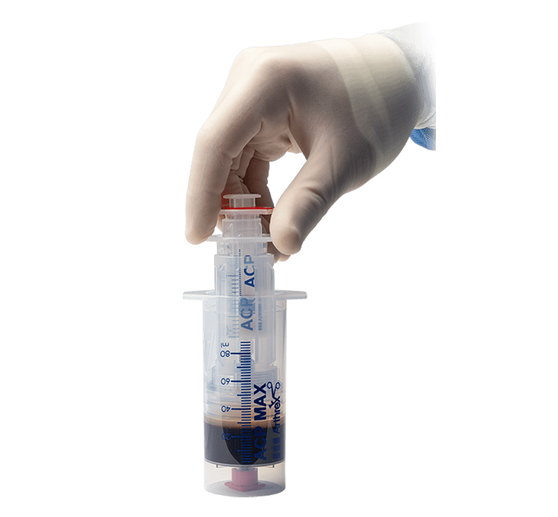 ACP Max™ PRP System