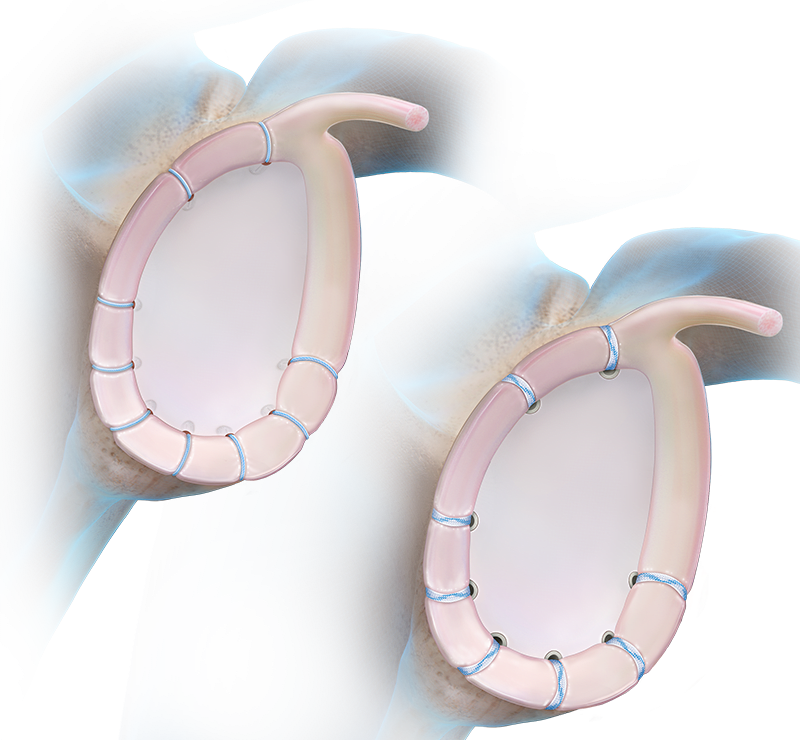 Multidirectional Instability
