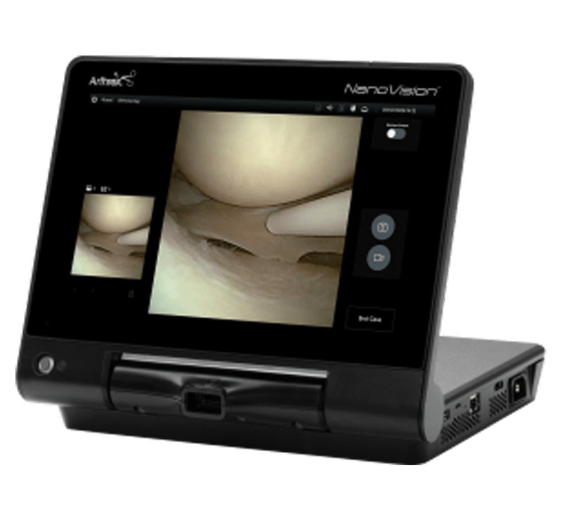 Nano Arthroscopy Console