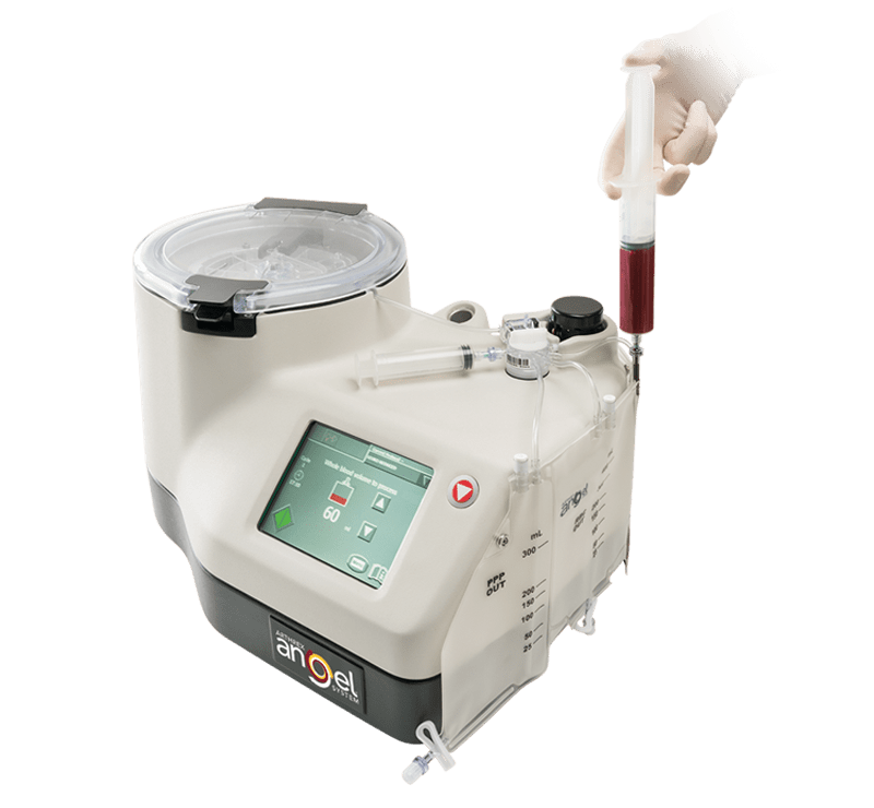 Arthrex Angel<sup>®</sup> System