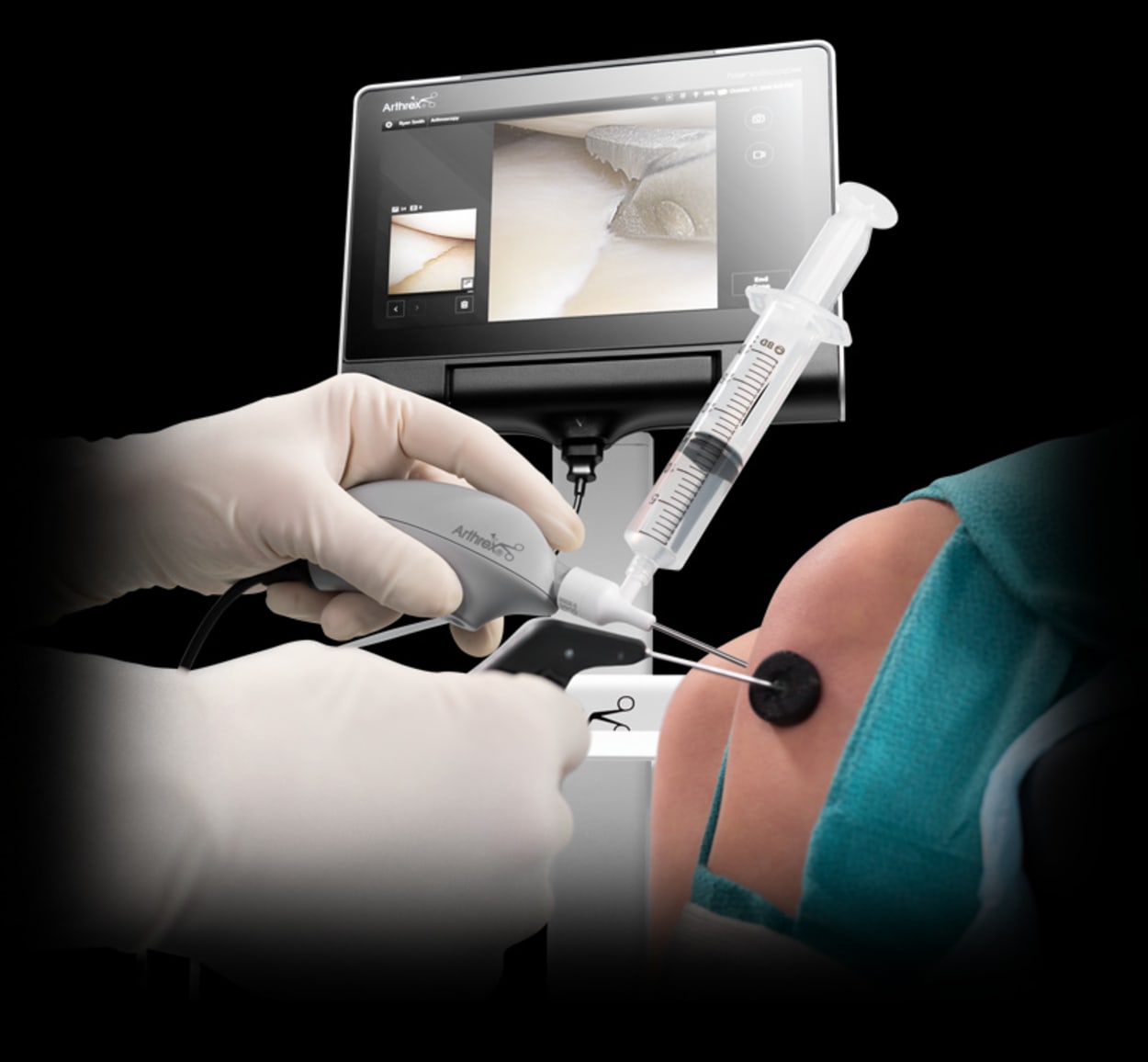 <p>Nano Arthroscopy</p>