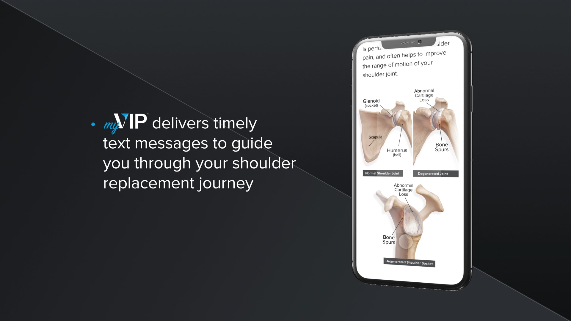 Arthrex - MyVIP Patient Texting Platform - Dravecky