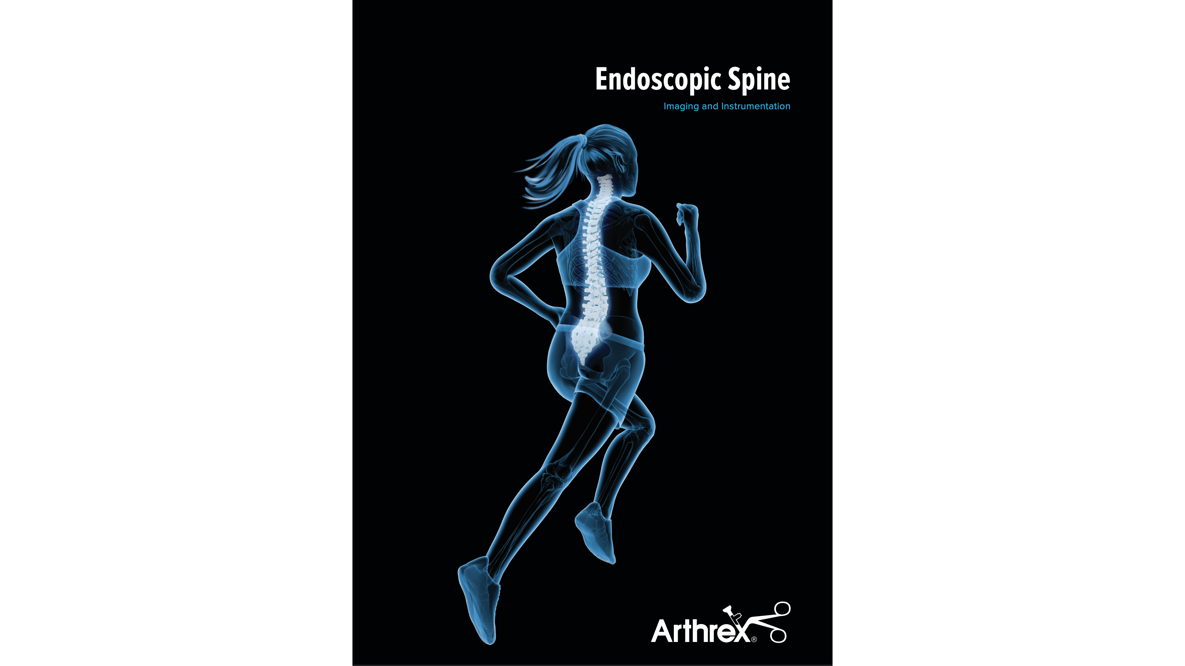 Endoscopic Spine