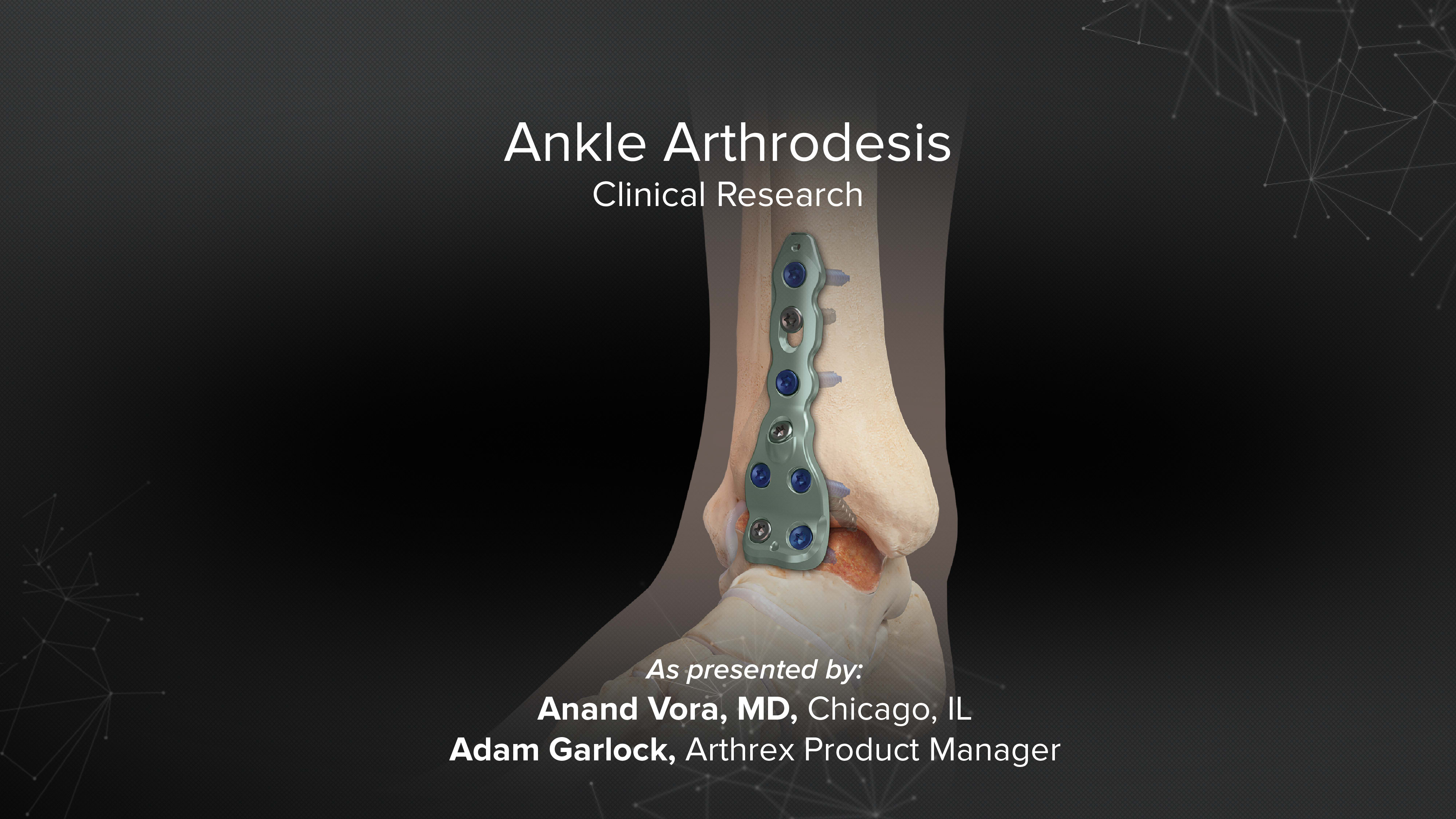 Ankle Arthrodesis: Clinical Research