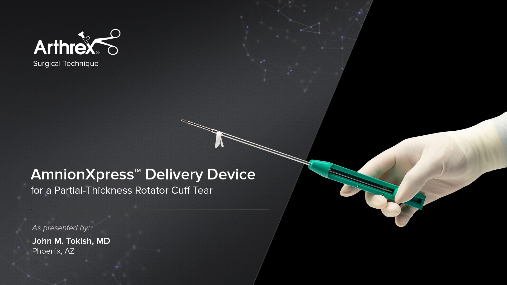 Arthrex - AmnionXpress™ Delivery Device for a Partial-Thickness Rotator ...