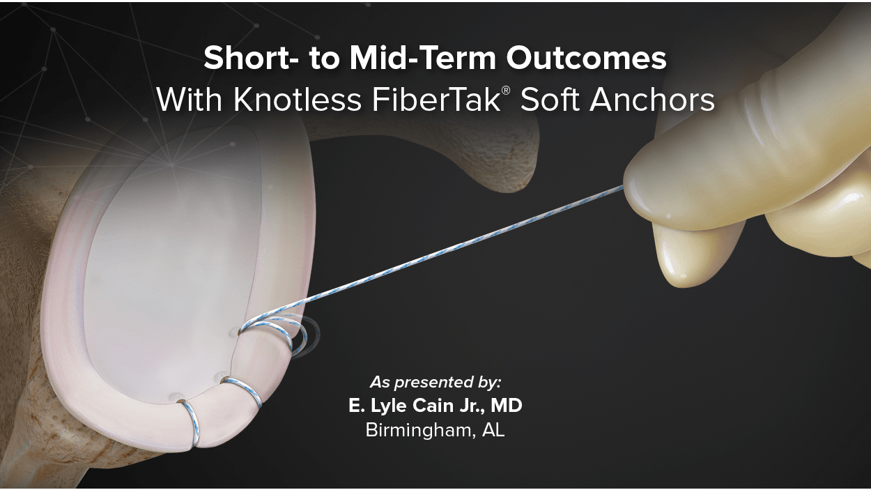 Short- to Mid-Term Outcomes With Knotless FiberTak® Soft Anchors