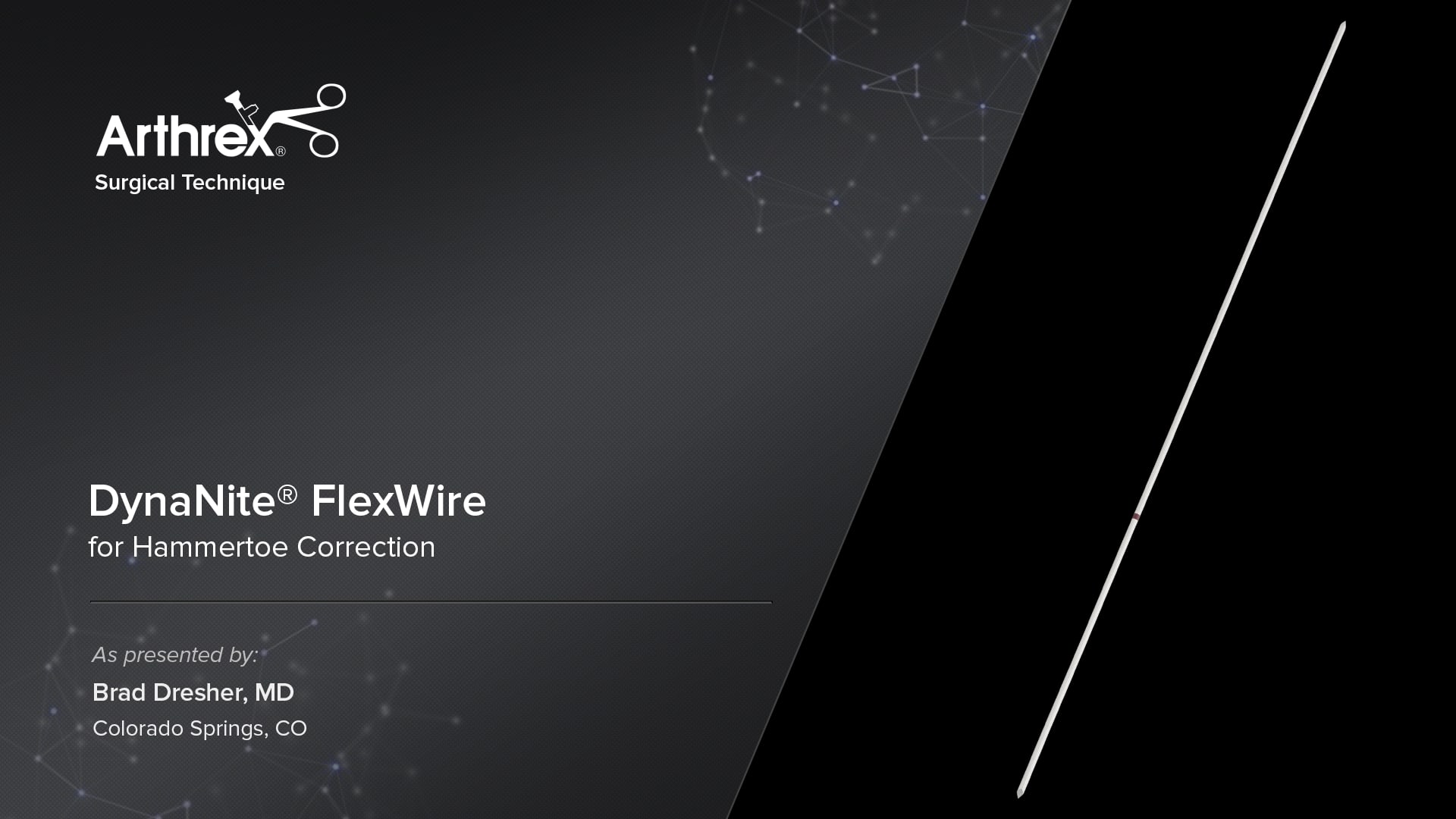 DynaNite® FlexWire for Hammertoe Correction