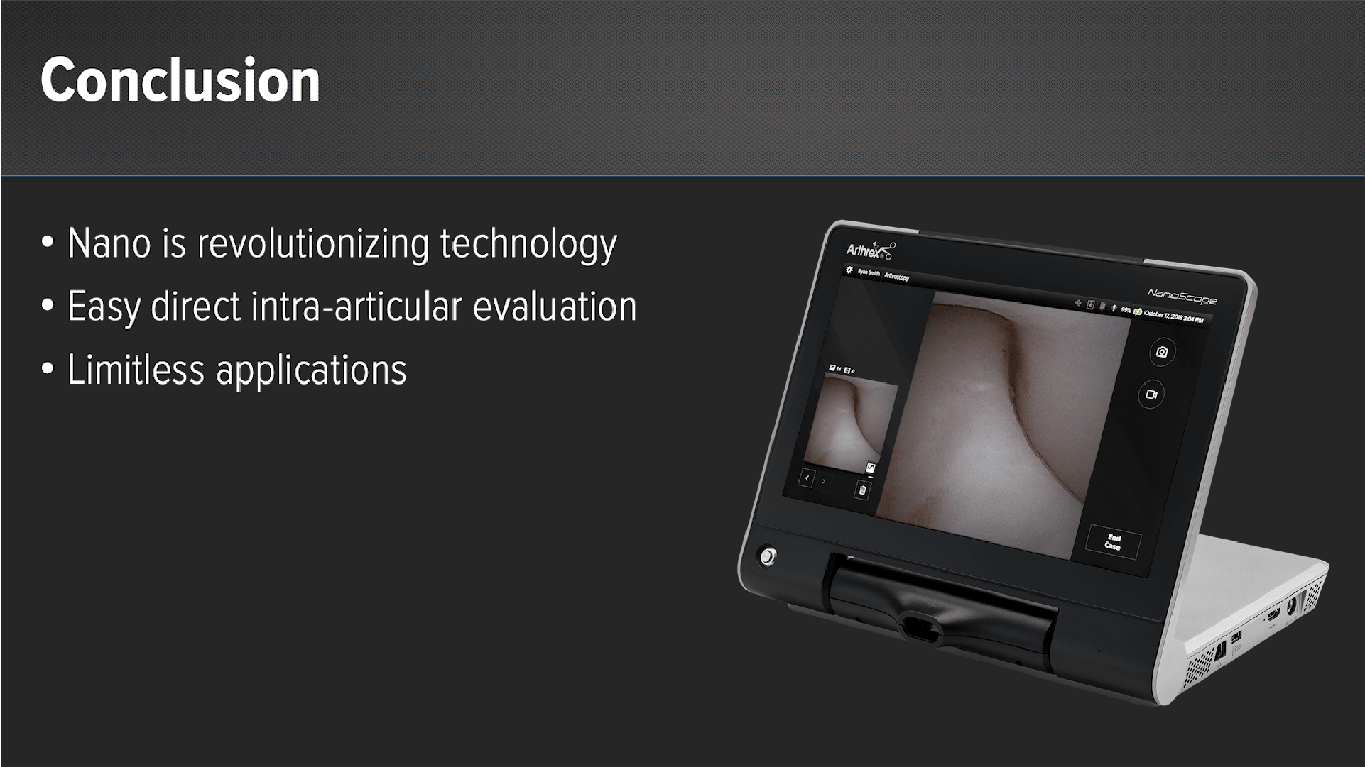 Arthrex - Clinical Value of the NanoScope™ System for Trauma Cases