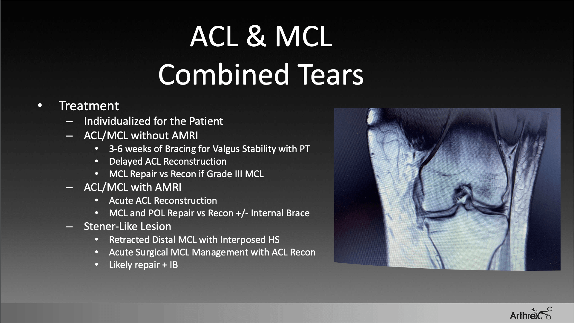 Advancements in the Treatment of Medial-Sided Knee Ligament Injuries