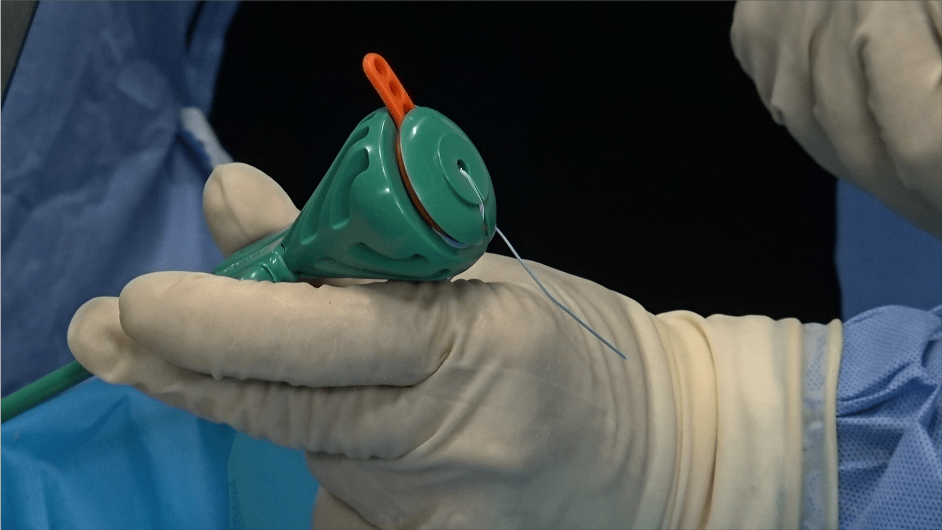 Arthrex open proximal hamstring tendon repair using a knotless