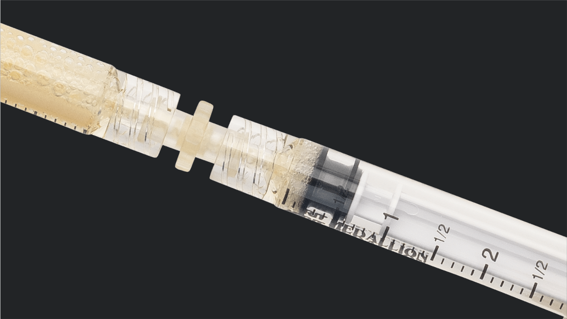 Treatment of Peroneal Tendinopathy and Tears With Interfyl® Connective Tissue Matrix