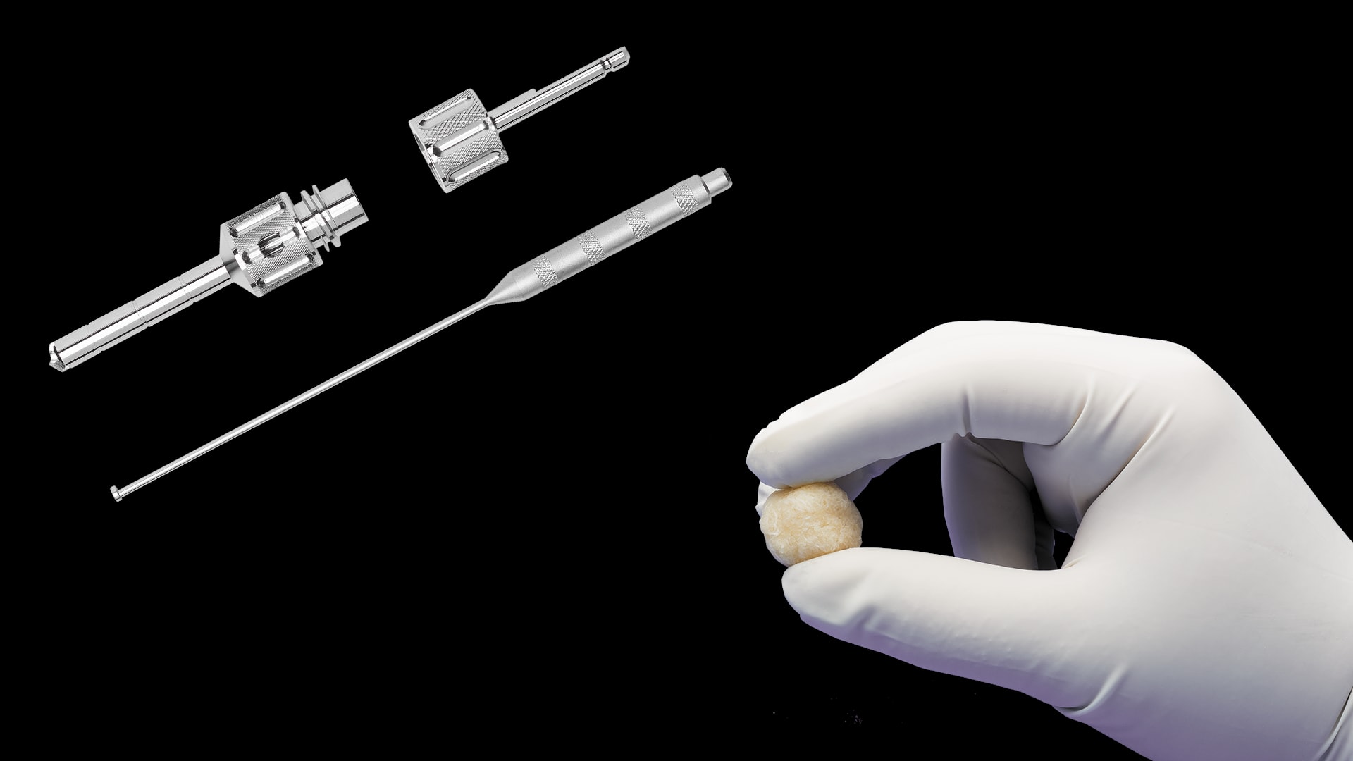Ankle Arthrodesis Augmented Using ArthroCell™ Bone Graft and OsteoAuger™ Bone Harvester