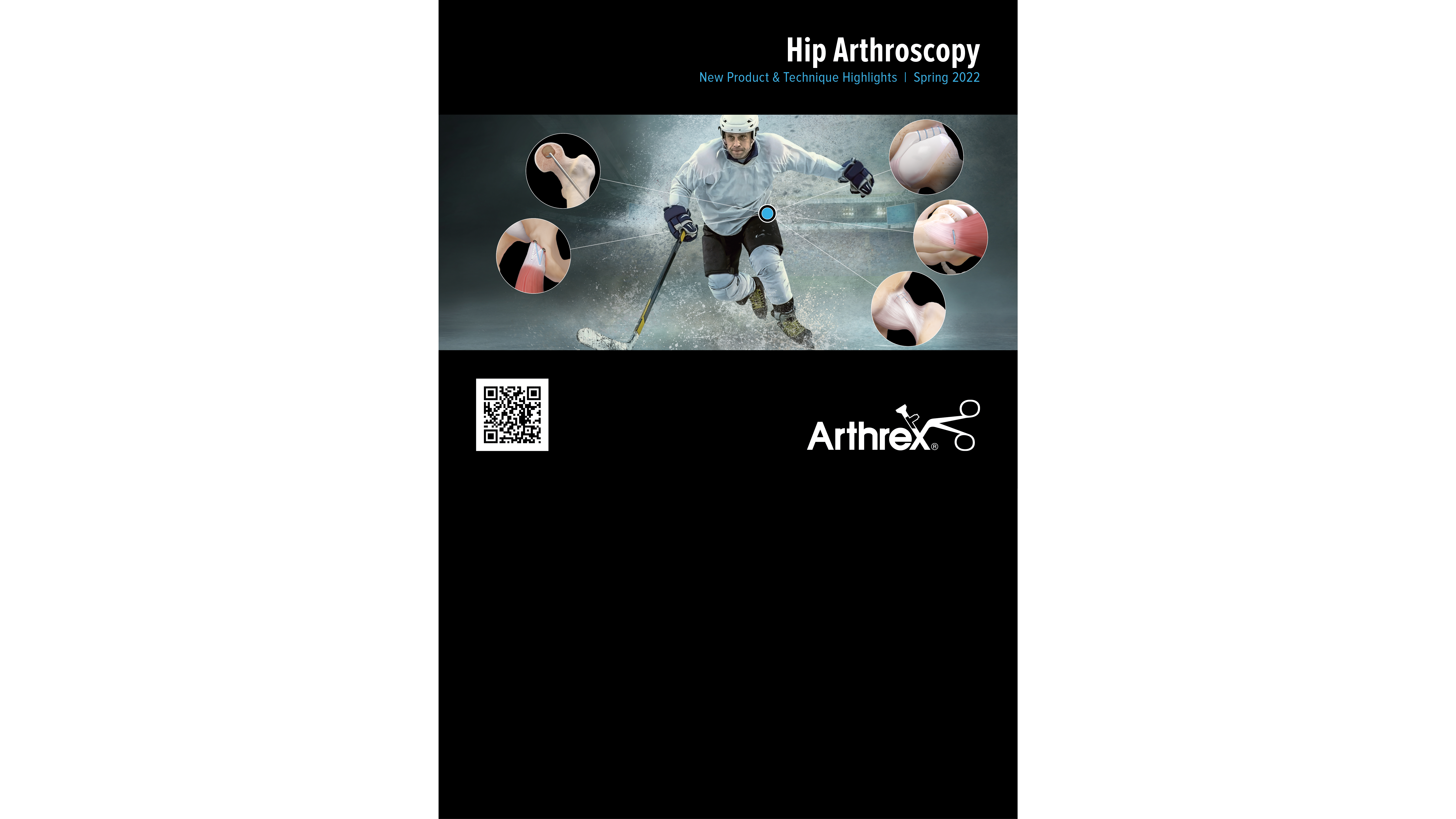 Hip Arthroscopy New Product & Technique Highlights